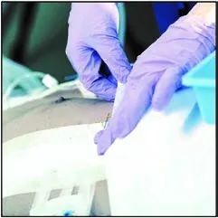 珠江视界|麻醉学科相关最新重要文献导读（2020.06）