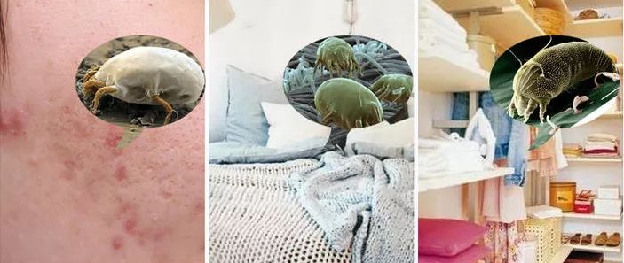 鼻头痘痘挤出来的白色物质是什么,团状红痘痘