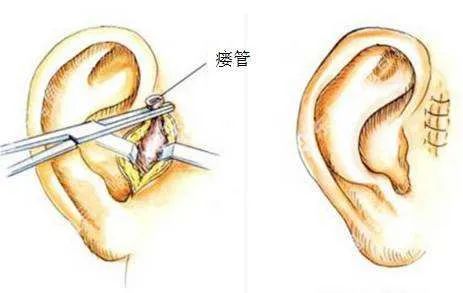 宝宝聪明洞,宝宝有聪明聪颖