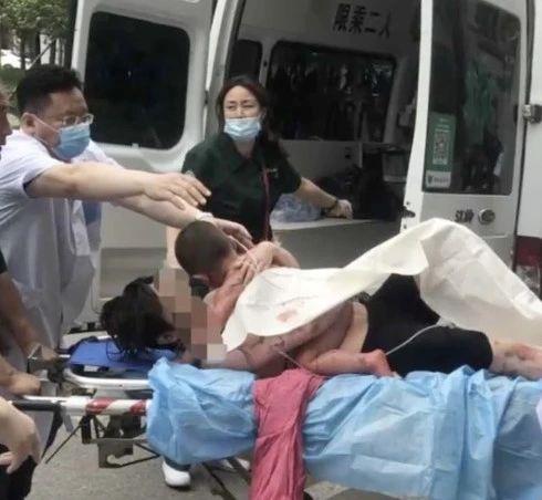 热水壶爆炸一家三口被特重度烧伤,热水器爆炸致一家三口重度烧伤