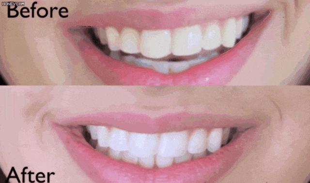 牙粉去烟渍牙结石牙膏排名第一名,美白牙膏推荐去牙黄老牌子