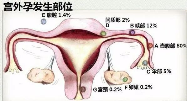科普女性分娩危险,妇产疾病相关知识