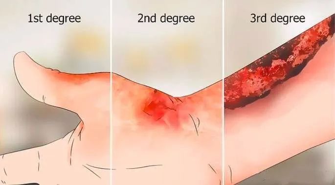 盘点那些差点让艺人丧命的危险,在拍戏中遭遇不幸的艺人