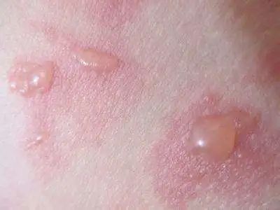 盘点那些差点让艺人丧命的危险,在拍戏中遭遇不幸的艺人