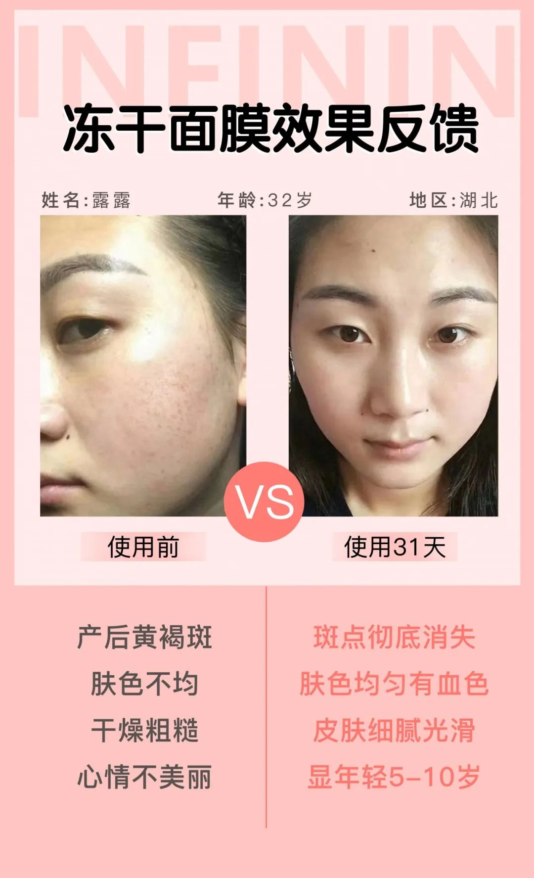 医护人员把这种鲜花当面膜，皮肤白嫩得让男人受不了，到底有多神奇？