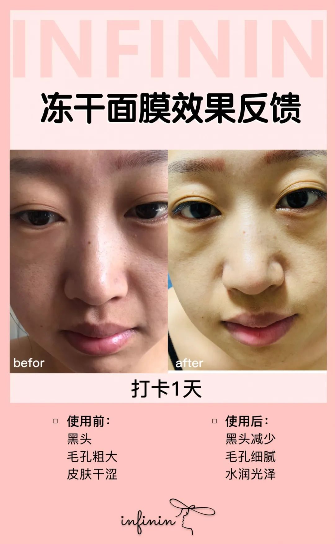 医护人员把这种鲜花当面膜，皮肤白嫩得让男人受不了，到底有多神奇？