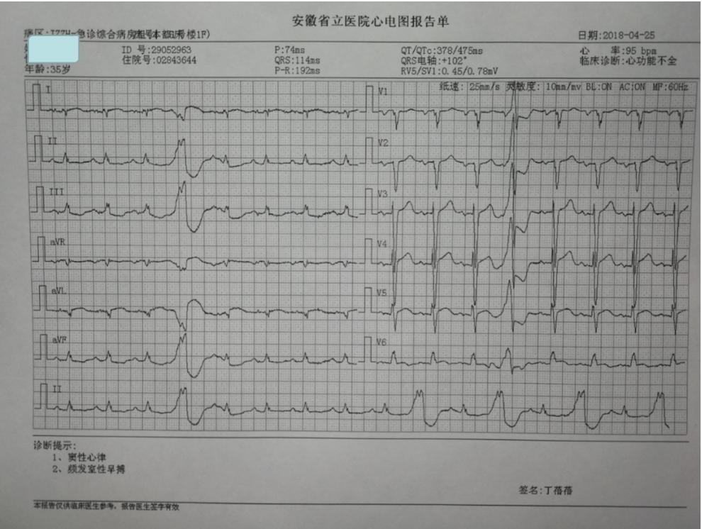 专家讲解arni药治疗心衰病例,抗心衰药物arni