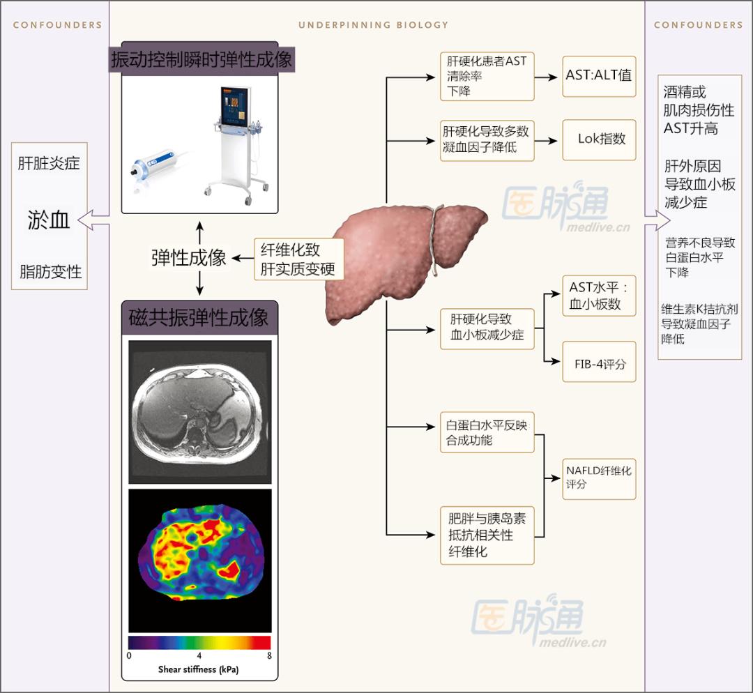 肝活检穿刺判断肿瘤,肝活检的条件