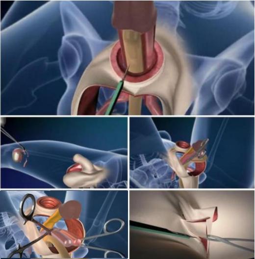 我跟一个做了变性手术的跨性别女生，聊了聊