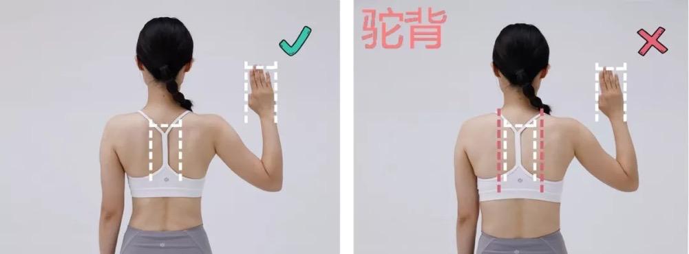 体态显老该怎样矫正图片,最难看的几种体态