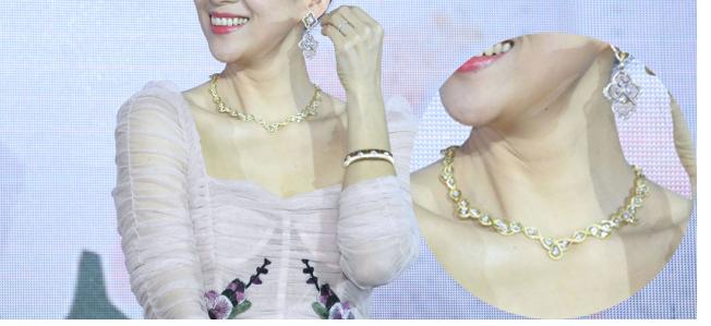 一条颈纹老十岁教你一招淡化,女人脖子有颈纹和年龄有关吗