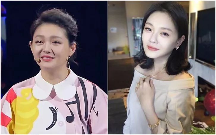 瘦脸小v脸的方法,每天张嘴闭嘴100下能瘦脸吗