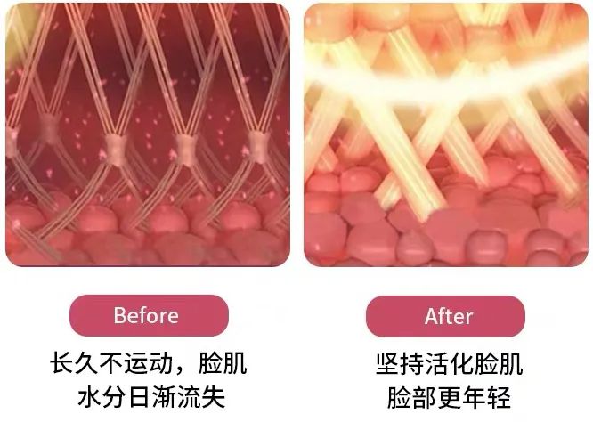 瘦脸小v脸的方法,每天张嘴闭嘴100下能瘦脸吗