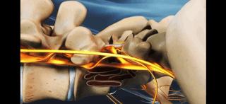 腰痛来龙去脉,腰疼真相