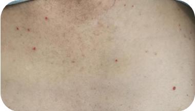 话肿瘤,肿瘤病人用了免疫治疗说胡话