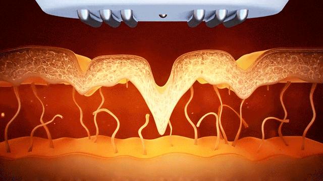 这个黑科技口碑人气王，只要10分钟让你有面膜的使用感