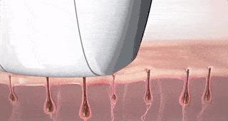 痘痘不再反复了怎么办,痘痘不消失怎么办