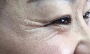 60岁没眼袋方法,教你一招去眼纹