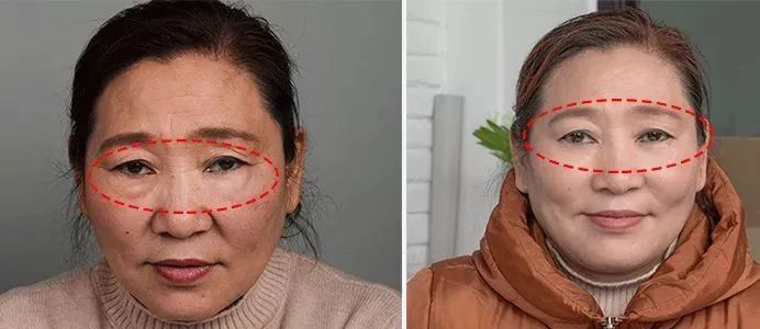 60岁没眼袋方法,教你一招去眼纹