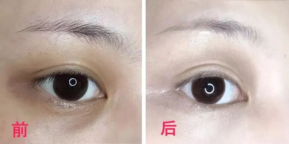 60岁没眼袋方法,教你一招去眼纹