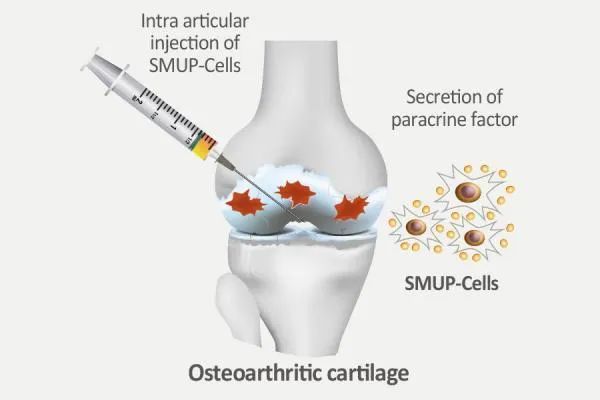 Medipost：聚焦脐血应用20年，释放再生医学潜力