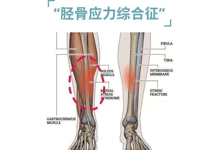 小腿迎面骨一阵一阵的疼,小腿迎面骨跳着疼
