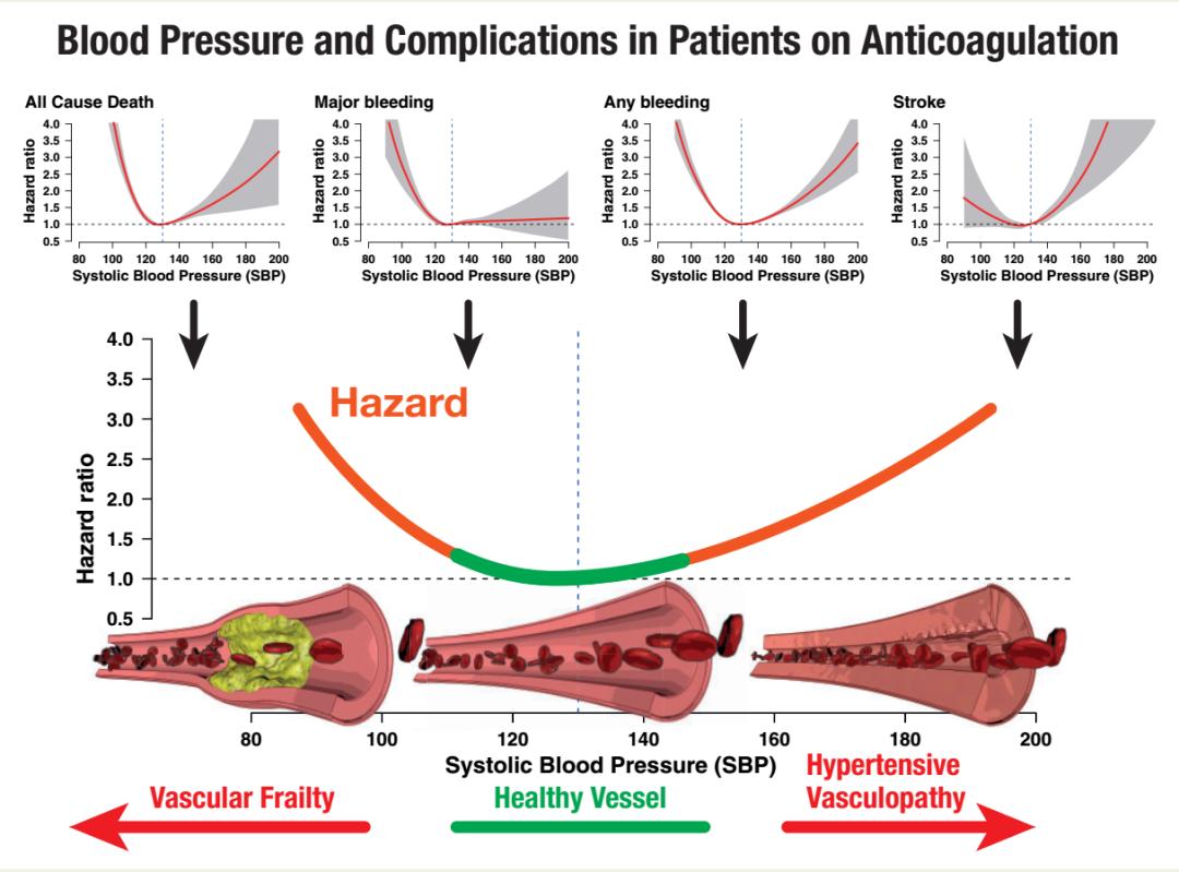 过低容易大出血，过高容易脑卒中——长期抗凝的房颤患者血压需控制到多少？｜安贞心语
