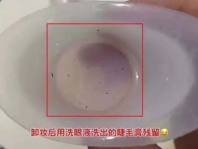 眼睛干涩、胀痛、*血丝红**？用眼过度，只需10秒，给眼睛来一次彻底大清洗，网友：眼里脏东西竟然这么多！洗后爽爆了