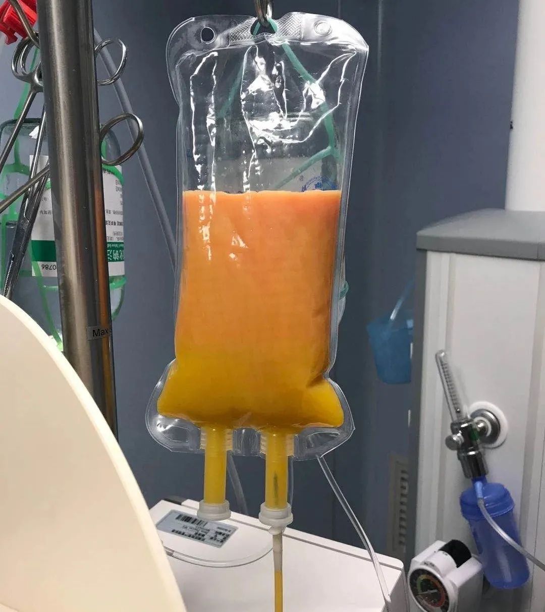 孕妇吃炸鸡2小时血糖6.5,孕早期不谨慎吃了隔夜的炸鸡