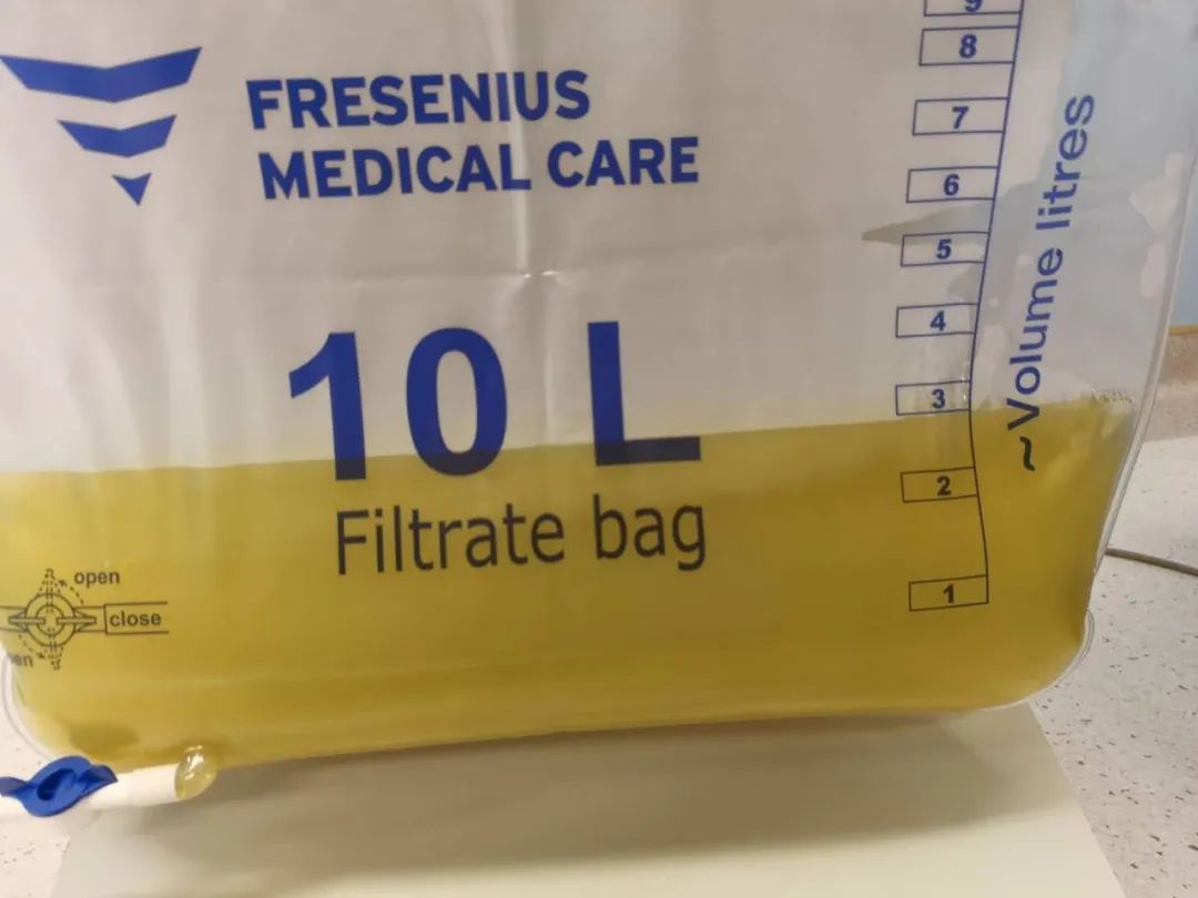 孕妇吃炸鸡2小时血糖6.5,孕早期不谨慎吃了隔夜的炸鸡