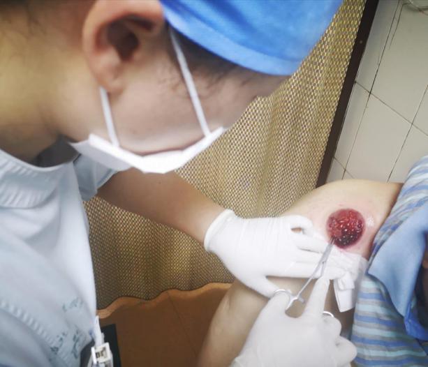 南京看伤口愈合的医院哪家好,北京治疗伤口愈合最好的医院