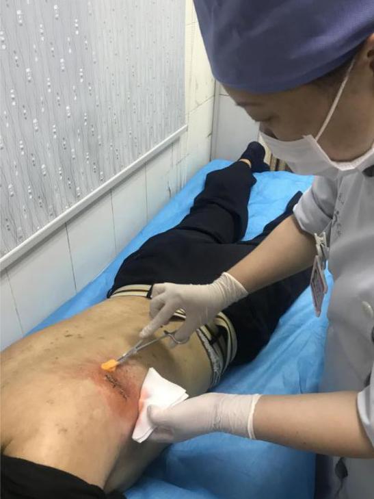 南京看伤口愈合的医院哪家好,北京治疗伤口愈合最好的医院