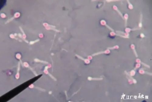 险！九江一高龄患者破伤风致重症危及生命ICU治疗一个半月仅因树枝刺伤被轻视