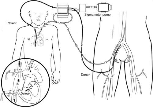 换就有生机！每年30万人在生死边缘排队等候…