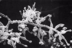 换就有生机！每年30万人在生死边缘排队等候…