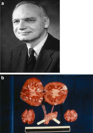 换就有生机！每年30万人在生死边缘排队等候…