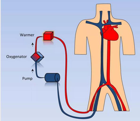 东莞这些医院有ECMO！被神化的利器背后，考量医院综合实力！