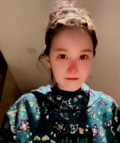 赵本山女儿整容成功了吗,赵本山女儿整容几次