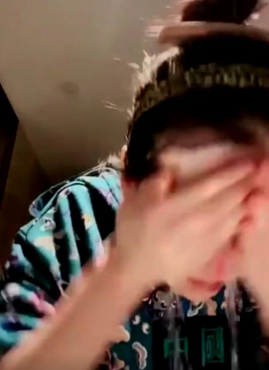 赵本山女儿整容成功了吗,赵本山女儿整容几次