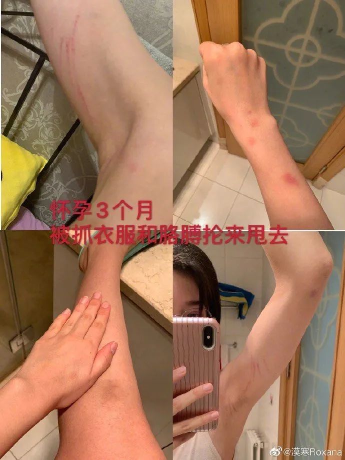 运动员家暴事件,著名运动员被家暴