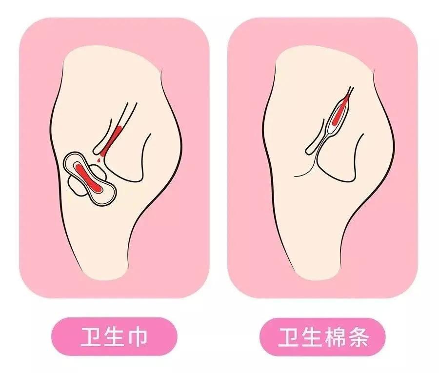 解决月经期量大、侧漏、有异味的好物，竟然还有人没用过？