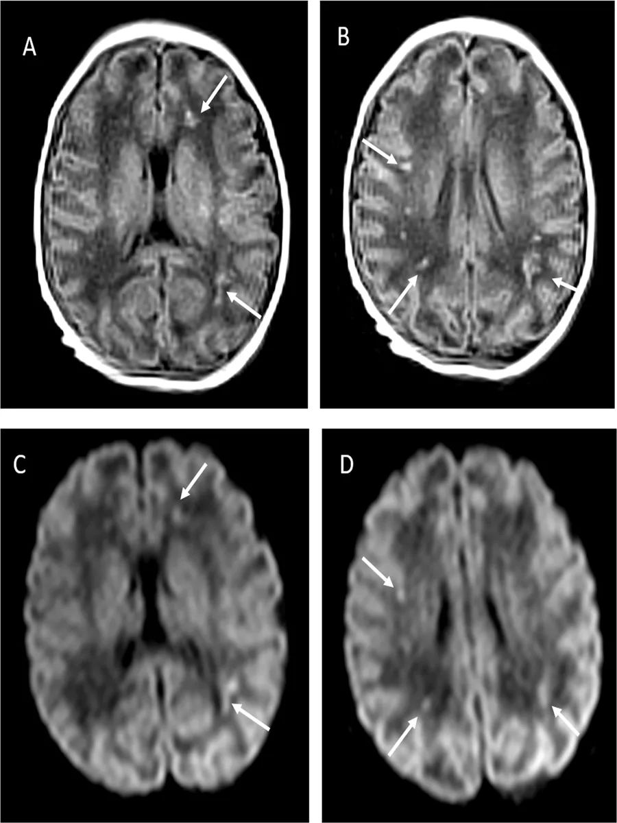 新冠病毒可通过母婴垂直传播吗？