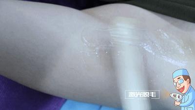 夏天女生该不该把腋毛剃掉,女生的腋毛可以剃吗