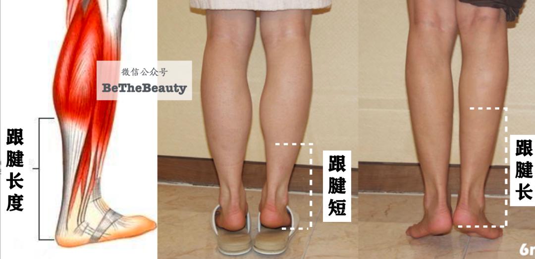 腿粗暗沉粗糙？为什么教程也救不了你的颜值bug？