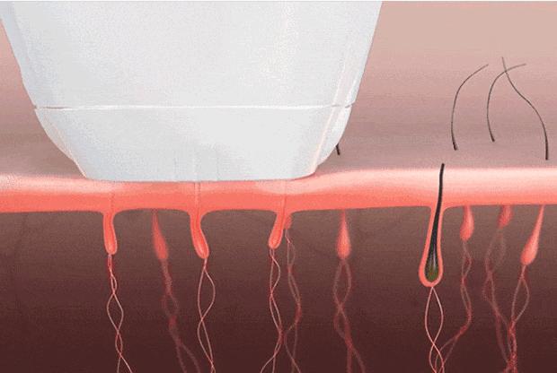 腿粗暗沉粗糙？为什么教程也救不了你的颜值bug？