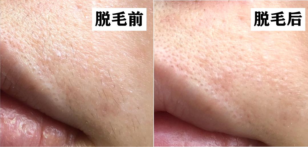 腿粗暗沉粗糙？为什么教程也救不了你的颜值bug？