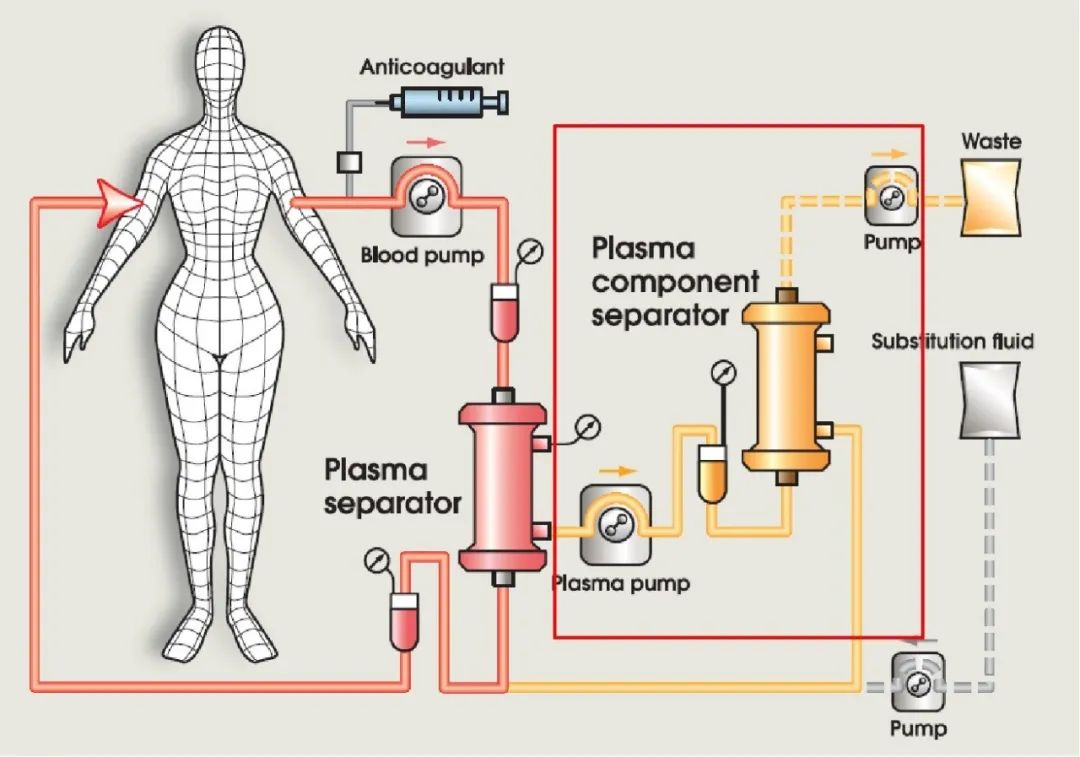 张晓良肾内科,肾病专家谈血液净化