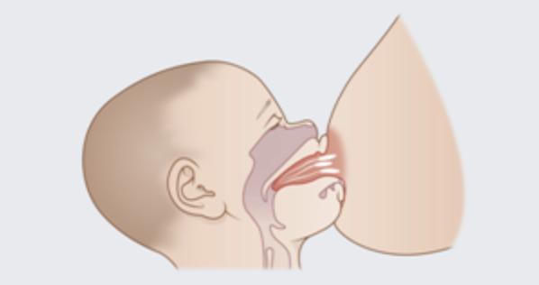 天天刷牙怎么还得龋齿,小孩天天刷牙怎么会蛀牙啊