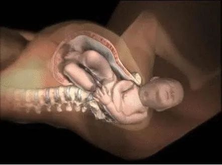 侧切技术,产后侧切45天后大便有点血