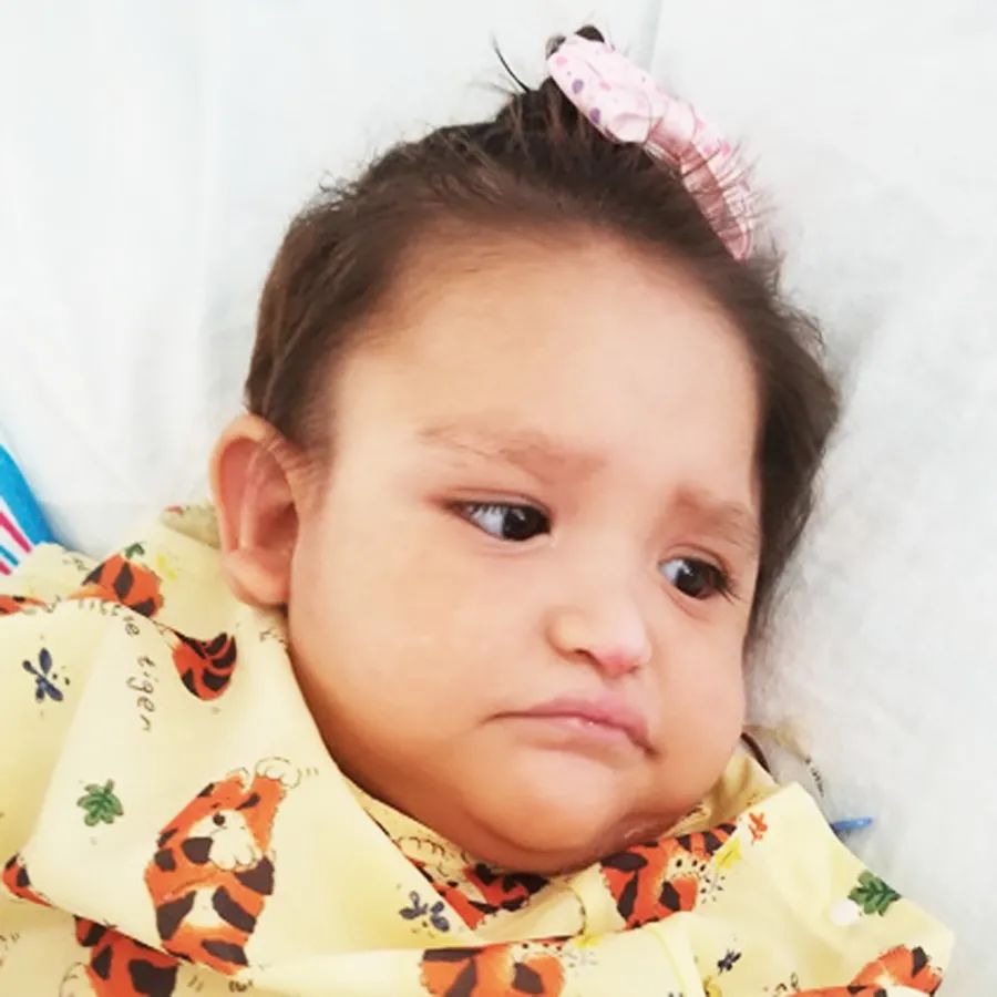 暴发性紫癜是什么原因引起的,暴发性紫癜是怎么回事